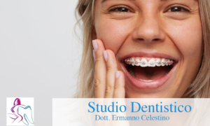 ORTODONZIA FISSA Studio Dentistico Dott. Ermanno Celestino Rende