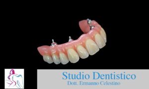 Toronto Bridge Studio Dentistico Dott. Ermanno Celestino Rende